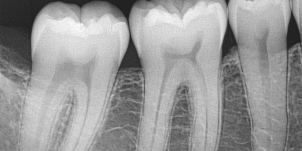 RX DIGITAL / Clínica Dental Alfaro